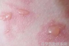 围困之主的孤独舞步